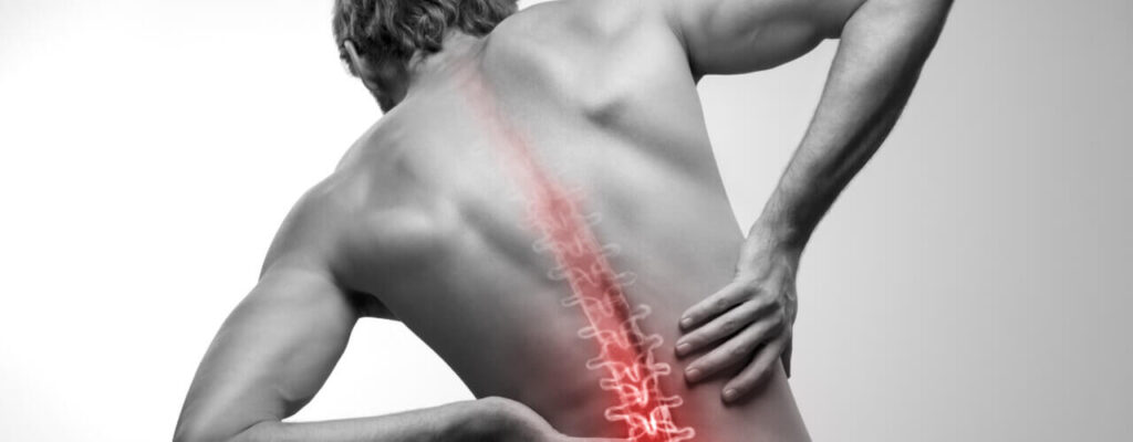 Improve posture in Bridge Physical Therapy