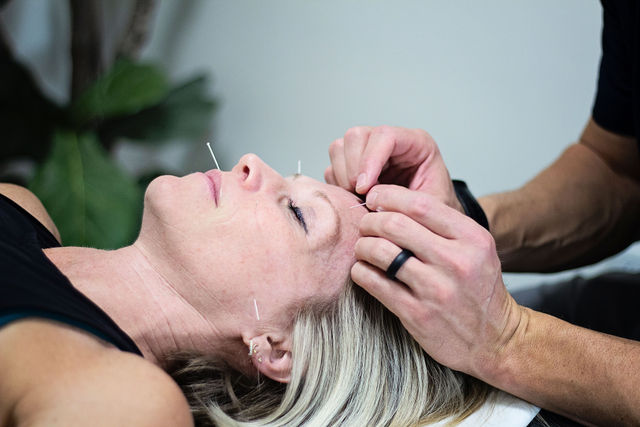 Does dry needling hurt?
